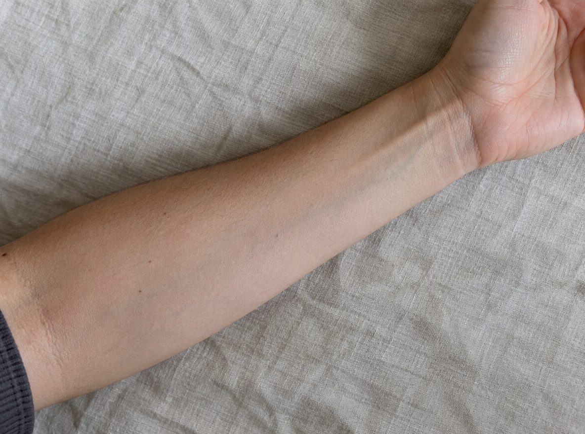Sample skin photo